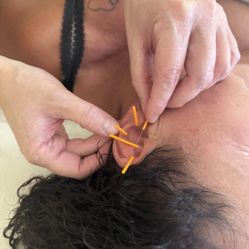 Øreakupunktur behandling hos akupunktør i Odense nær Stige og Lundby