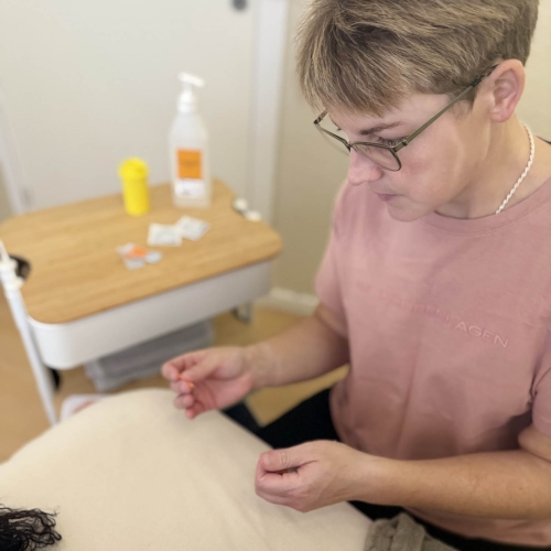 Akupunktør udfører akupunktur behandling hos klinik i Odense
