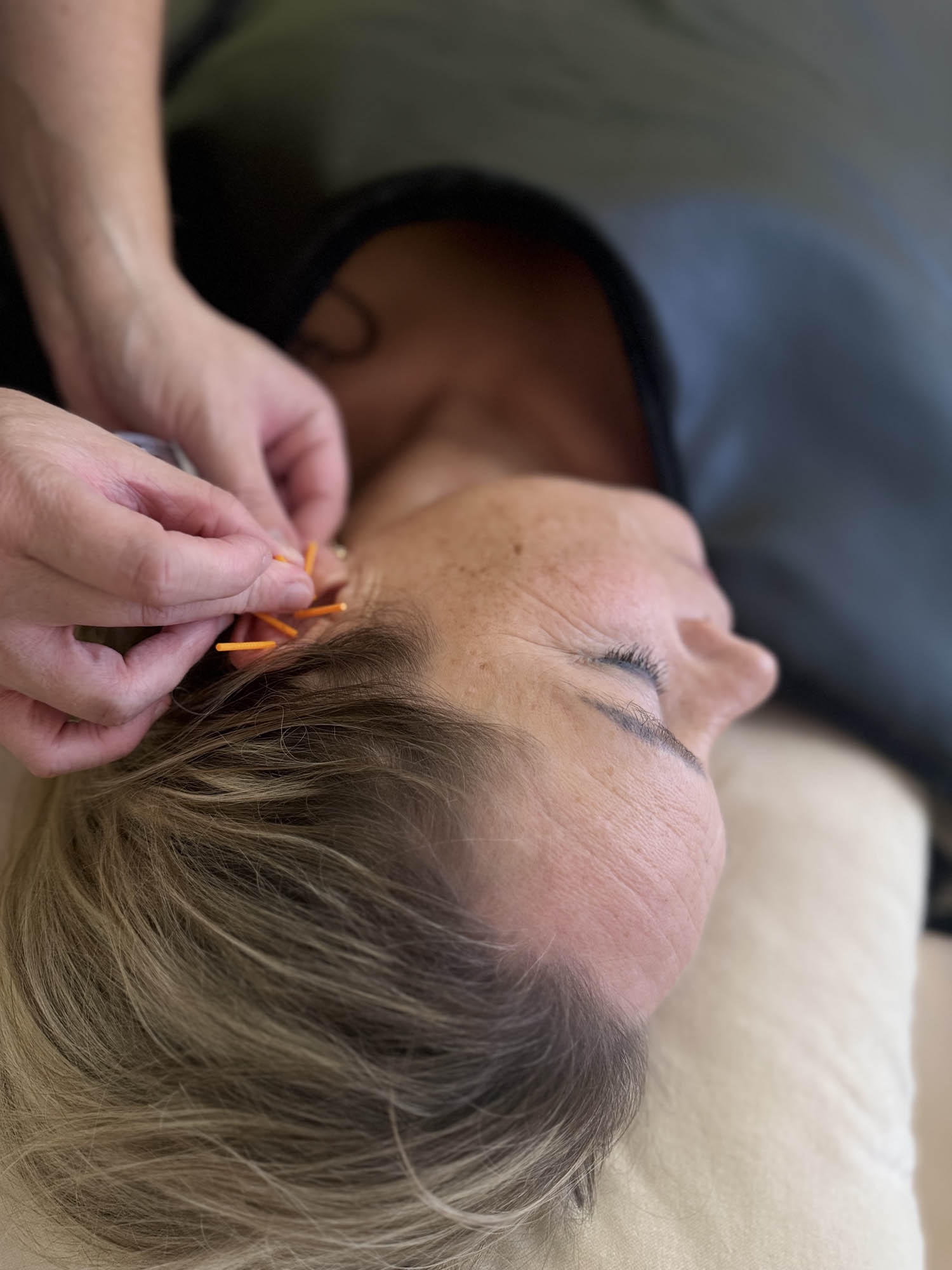 Øreakupunkturbehandling hos akupunktør i Odense nær Tarup og Stige